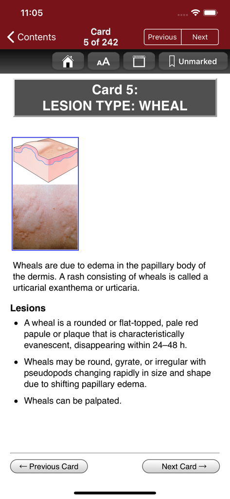 A study card for wheal lesion types in the Fitzpatrick's Derm Flash Cards medical app.