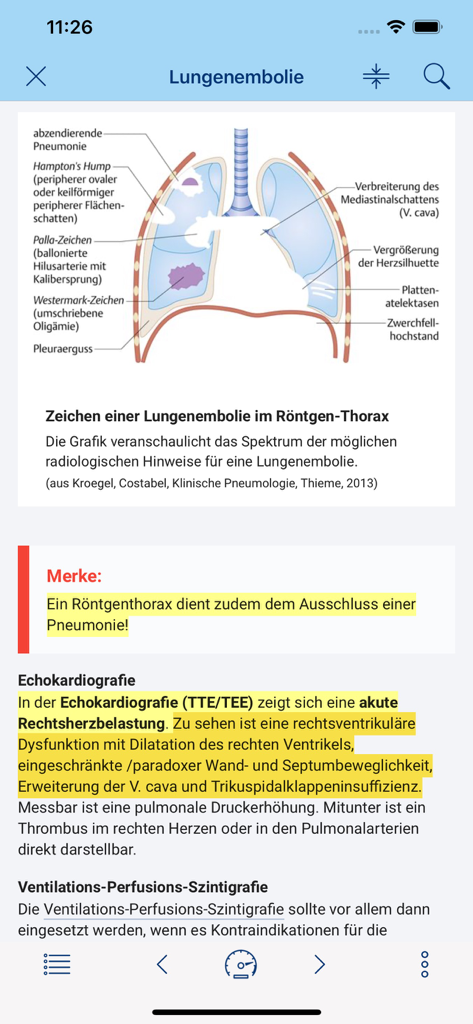 via medici WISSEN TO GO - Uma página de estudo médico sobre embolia pulmonar apresentando um diagrama de pulmão e texto em alemão