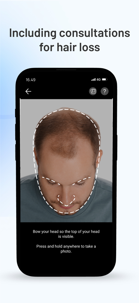 Miiskin: Rx Dermatology Visits - Miiskin app scalp photo guide for hair loss consultations