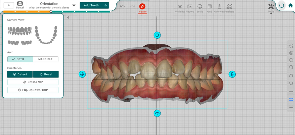 Interface of Titan Dental Design showing a 3D scan of a patient's teeth being oriented for treatment planning.