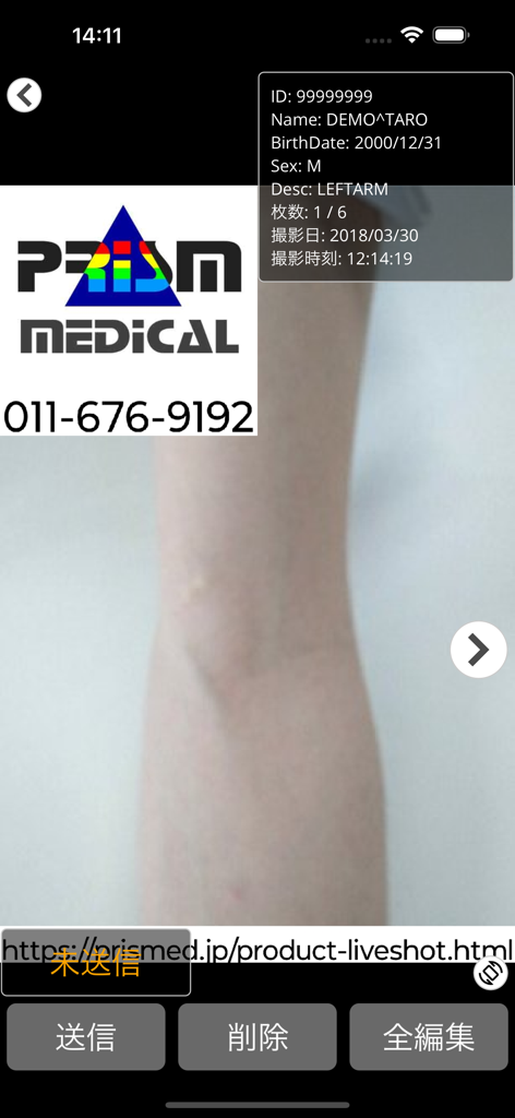 LiveShot2 - DICOM画像撮影 - LiveShot2 app interface displaying a clinical photo of an arm with patient DICOM metadata