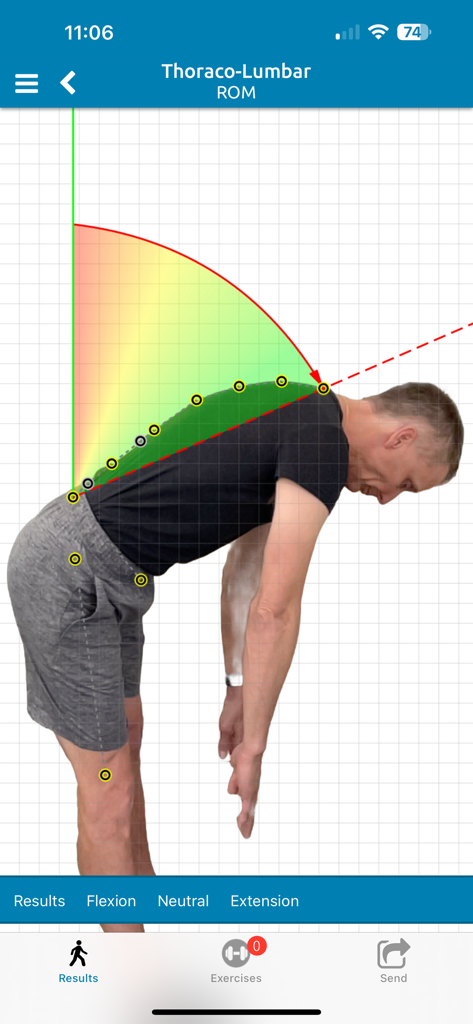 Thoraco-lumbar range of motion assessment with digital flexion analysis in PostureScreen Mobile app