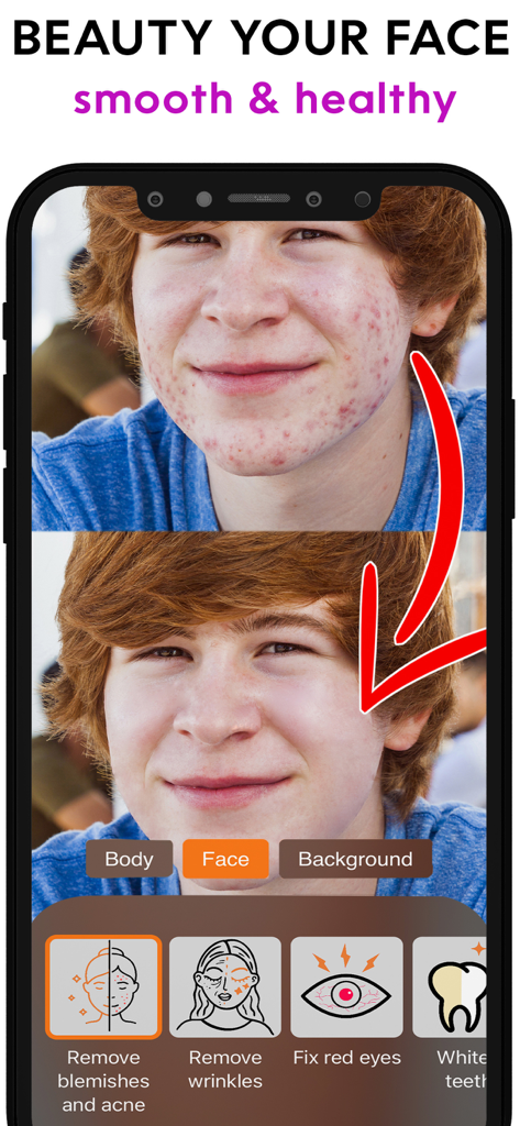Face & Body Editor: Retouch Do - Comparación de antes y después de un rostro mostrando resultados profesionales de eliminación de acné y imperfecciones en la aplicación Retouch Do