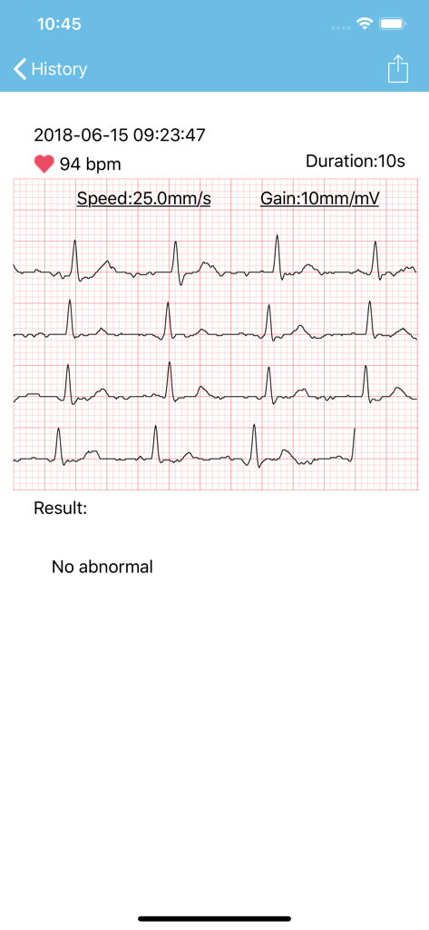 mini ECG - Medical App | MWM
