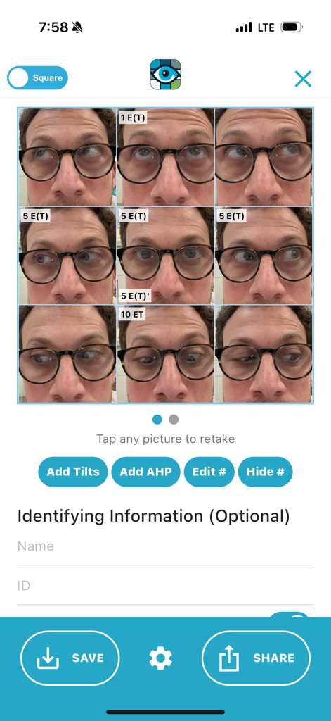 9 Gaze - Cuadrícula compuesta de fotos de motilidad ocular y documentación de estrabismo en la aplicación 9 Gaze