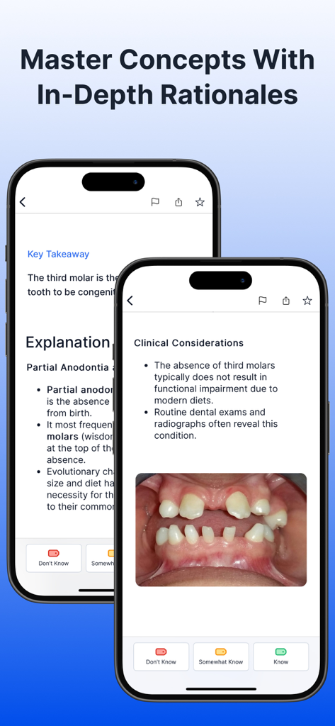 Dental Boards Mastery app interface showing detailed clinical rationales and dental photos