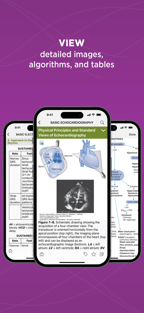 Pantallas de smartphone que muestran diagramas de ecocardiografía médica, algoritmos de diagnóstico y tablas clínicas dentro de la aplicación