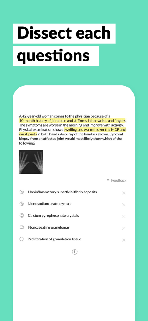 AMBOSS Qbank for Medical Exams - Pregunta de práctica de examen médico con información clave resaltada y una imagen de rayos X en la aplicación AMBOSS