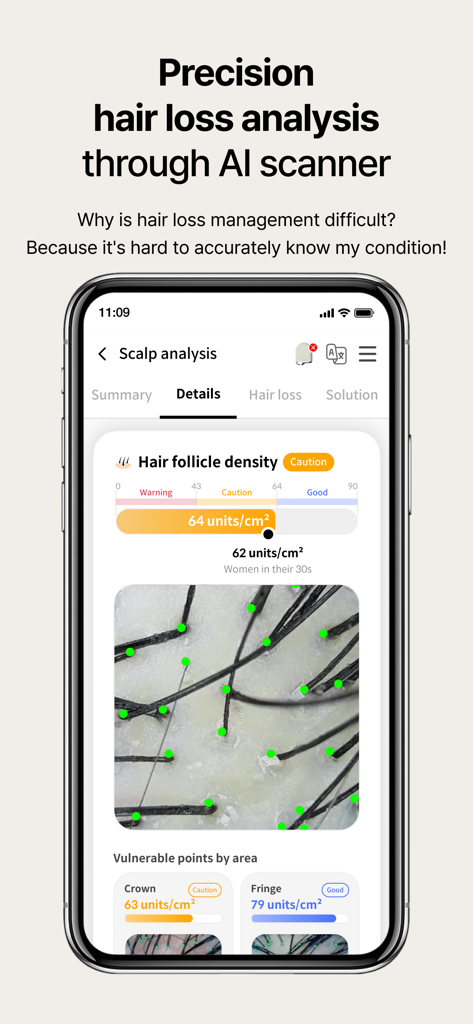 Análise de couro cabeludo com IA mostrando a densidade dos folículos pilosos em um dispositivo móvel