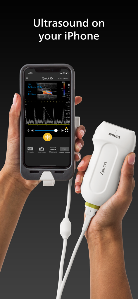 A medical professional using the Philips Lumify handheld ultrasound transducer connected to an iPhone showing a diagnostic scan.
