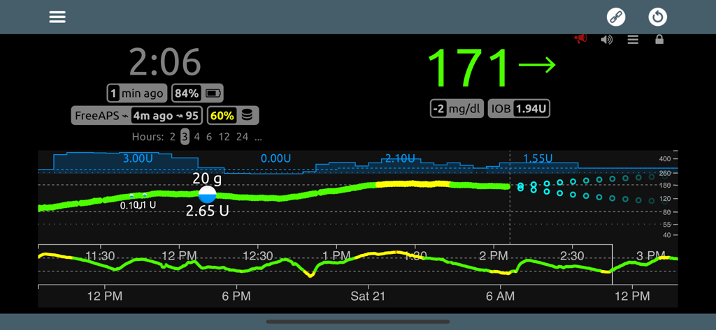 Nightscout X app dashboard showing real-time blood glucose levels and insulin tracking graphs