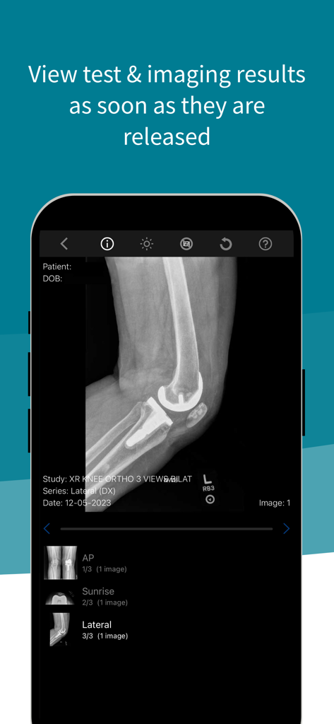 Mobile screen showing a knee X-ray imaging result within the Stanford Health Care MyHealth app.