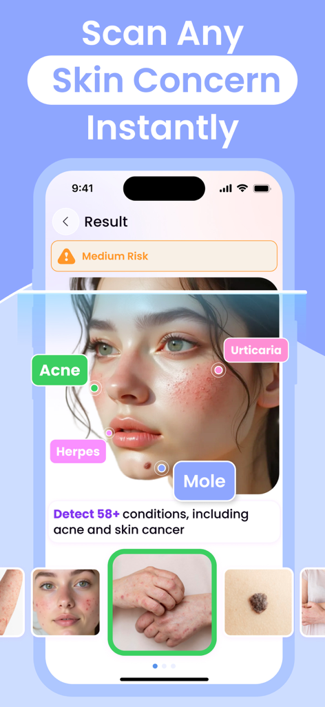Interfaz de la aplicación Escáner de Piel IA que muestra la identificación de lunares y erupciones en un rostro.