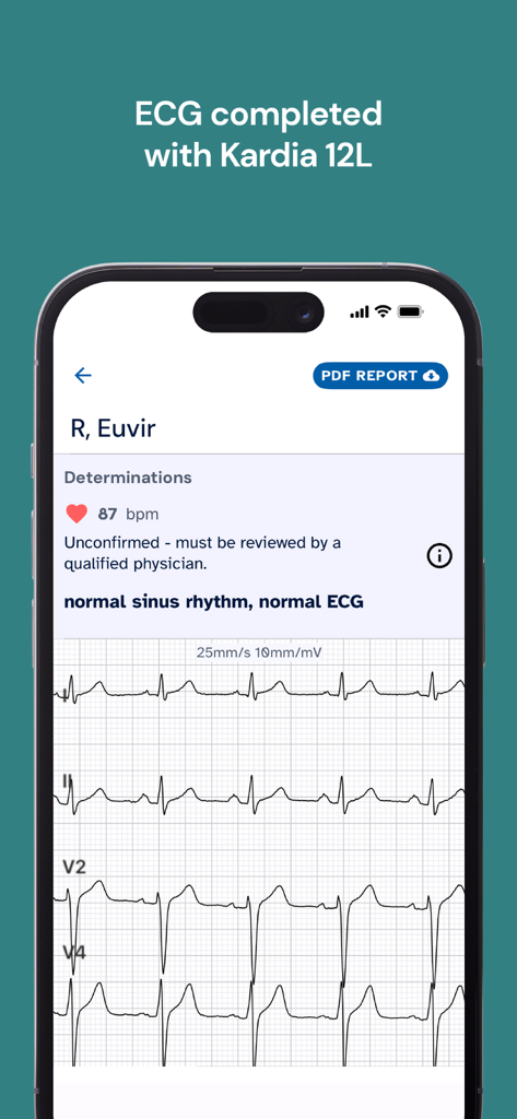 KardiaStation Professional - Pantalla móvil que muestra un informe profesional de ECG de 12 derivaciones con análisis de frecuencia cardíaca y ritmo en KardiaStation Professional.