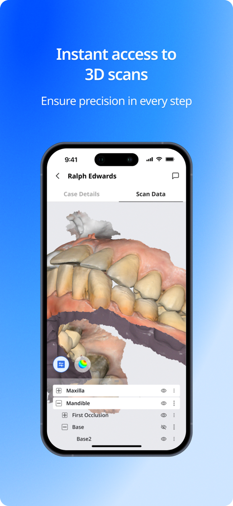 MEDIT M - Smartphone displaying a detailed 3D dental scan of teeth in the MEDIT M app