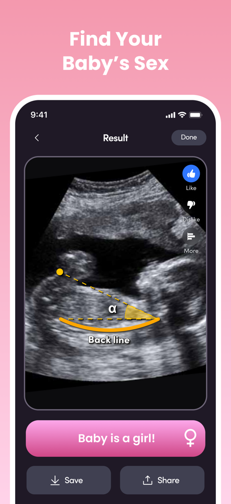NubX: Gender Reveal& Baby Scan - NubX app result screen showing a girl gender prediction from an ultrasound scan using AI analysis.