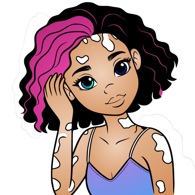 vitiligo black girl