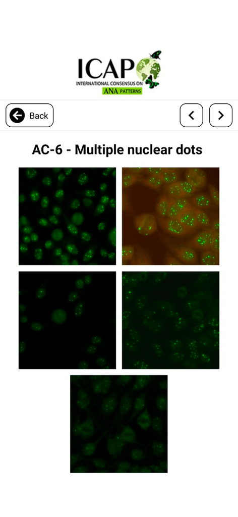 Imágenes microscópicas del patrón ANA AC-6 Puntos nucleares múltiples en la aplicación ICAP