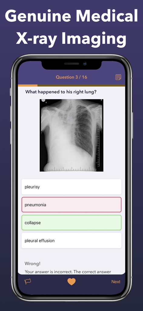Mobile app interface showing a radiology board review quiz with a lung x-ray image and multiple-choice questions.