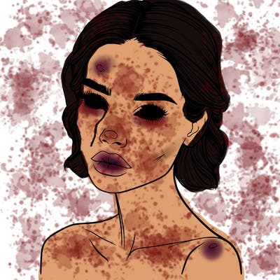 a fashion model with skin marks on her face realistic