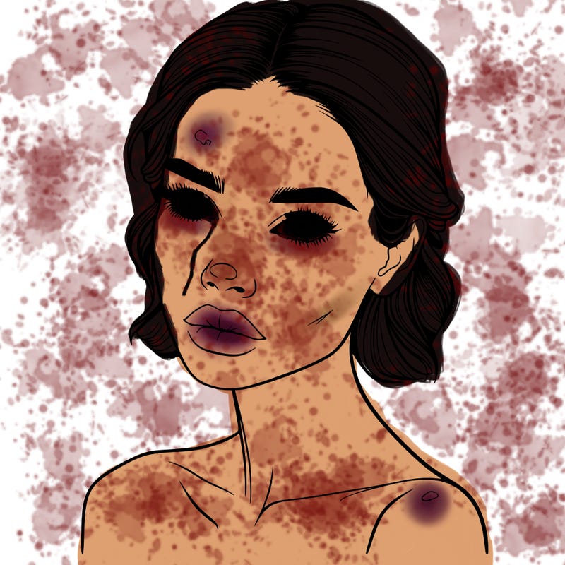 a fashion model with skin marks on her face realistic