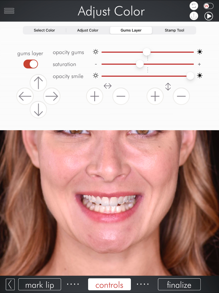 Interfaz de la DSD App mostrando herramientas para ajustar el color y la opacidad de la capa de encías para el diseño digital de sonrisa