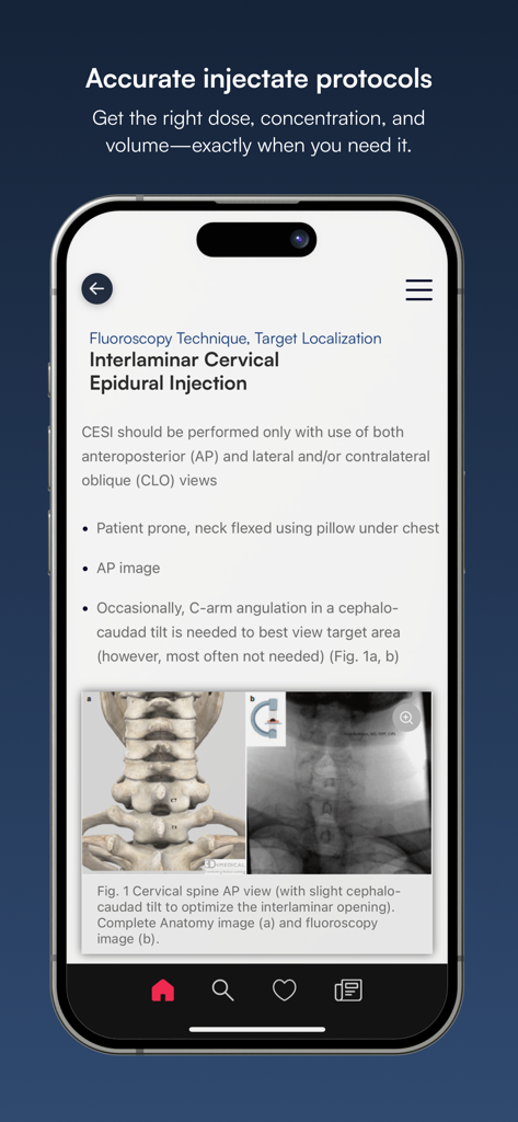 NYSORA Pain Medicine Assistant app displaying clinical instructions and fluoroscopy images for an interlaminar cervical epidural injection.