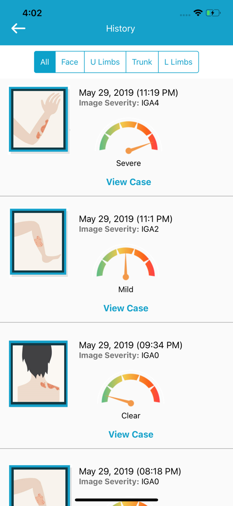 EczemaLess, an AI Eczema Guide - EczemaLess app history screen showing logs of skin condition severity with dates, body part illustrations, and severity gauges.