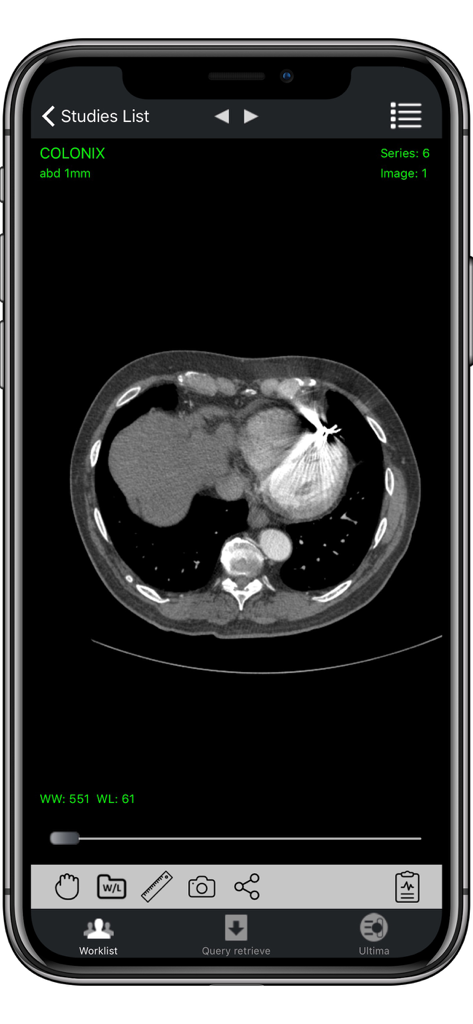 A medical DICOM image viewer app showing a cross-sectional CT scan with diagnostic tools