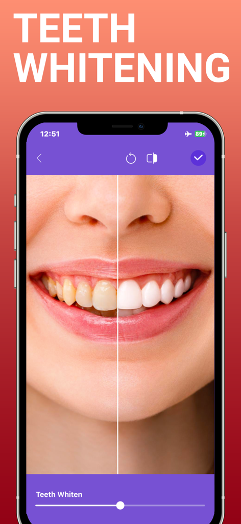 BeautyTune - Blemish Remover - Comparación de antes y después de los resultados de blanqueamiento dental en la aplicación BeautyTune