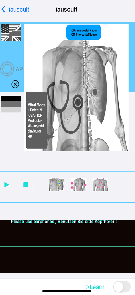 心音聴診のための聴診器の配置を示すiauscultアプリの解剖学的胸部図。