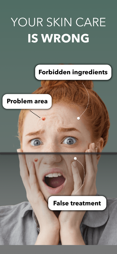 Face Skin Care Analysis⋆ - AI 피부 분석 화면에 여성 얼굴의 문제 영역과 금지 성분이 표시되어 있습니다.