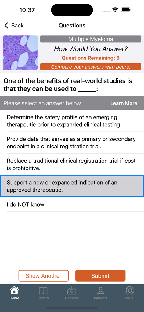 Mobile app interface showing a multiple choice medical question about multiple myeloma with peer comparison options