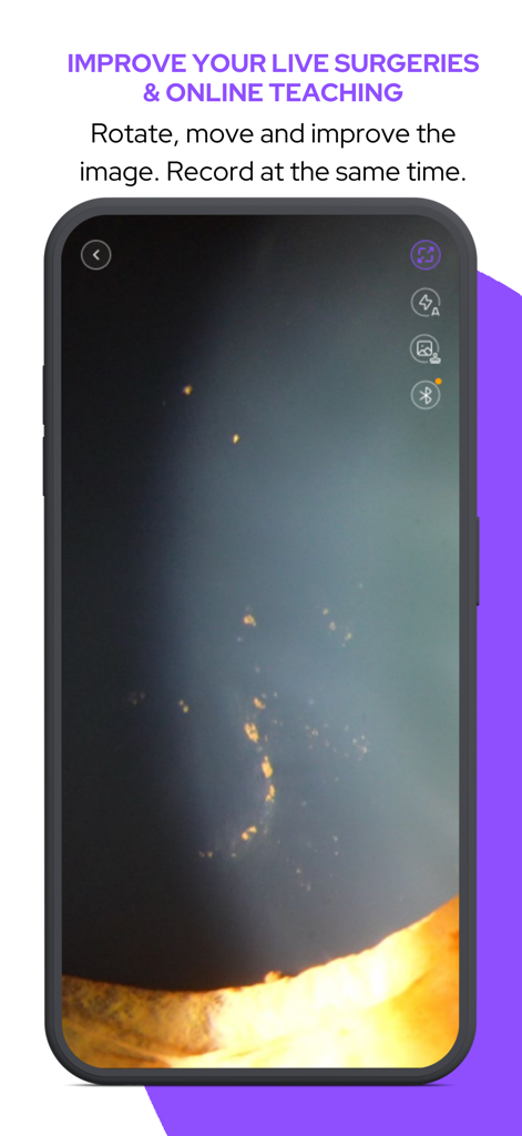 MicroREC App - MicroREC App interface on a smartphone for recording live surgeries and online teaching with image improvement tools