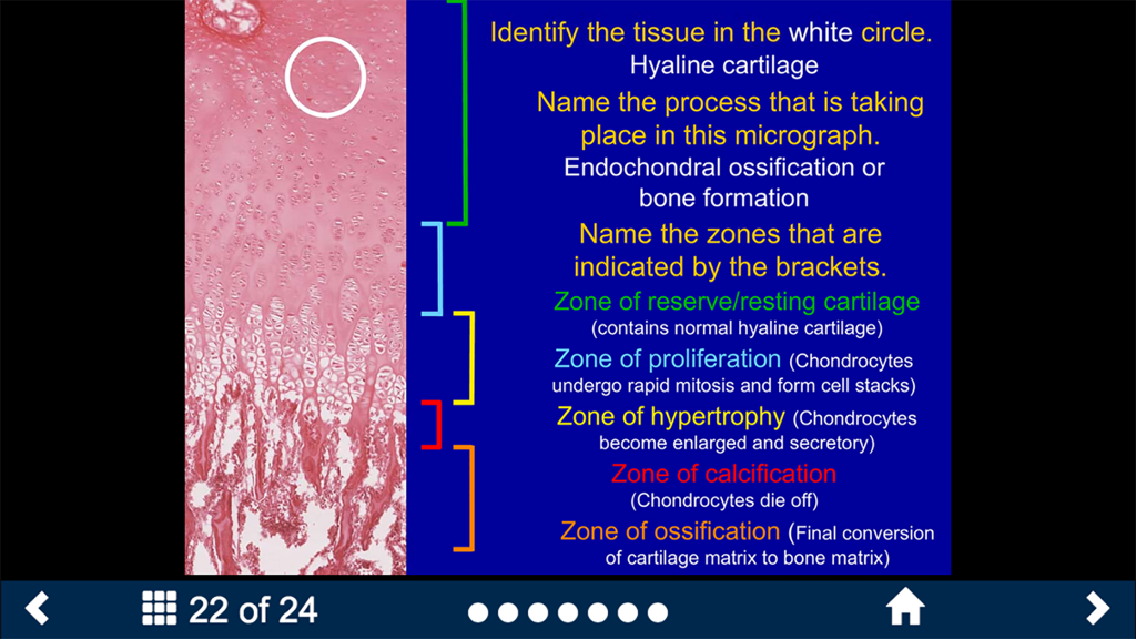 Histology Complete -SecondLook - Histology SecondLook app interface showing a micrograph of bone formation with self-test questions and anatomical labels.