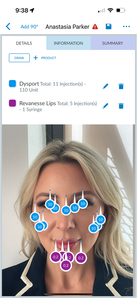 Clinical charting interface showing a woman's face with digital overlays marking injection locations and units for Dysport and Revanesse Lips.