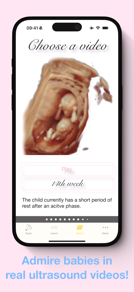 A smartphone screen from the ScanBaby app showing a 3D ultrasound video of a fetus at 14 weeks of development.