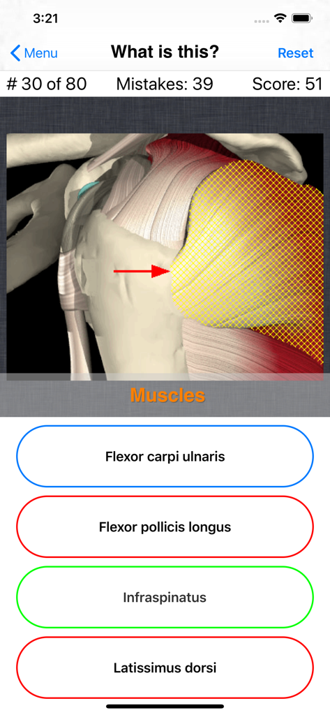 Anatomy Shoulder Quiz - A mobile quiz interface for shoulder anatomy showing an illustration of a shoulder muscle with a question and multiple choice answers.