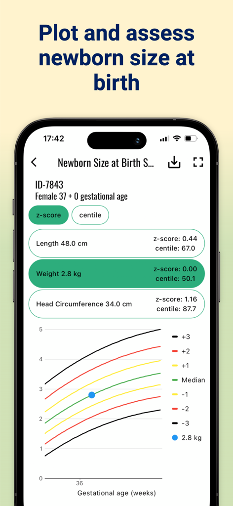 Interface do aplicativo INTERGROWTH-21st exibindo dados de tamanho de recém-nascido ao nascer e gráfico de crescimento.