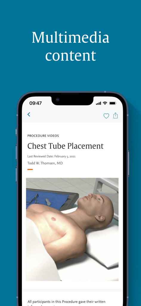 ClinicalKey - ClinicalKey app screenshot displaying a medical procedure video for chest tube placement with a 3D anatomical model.