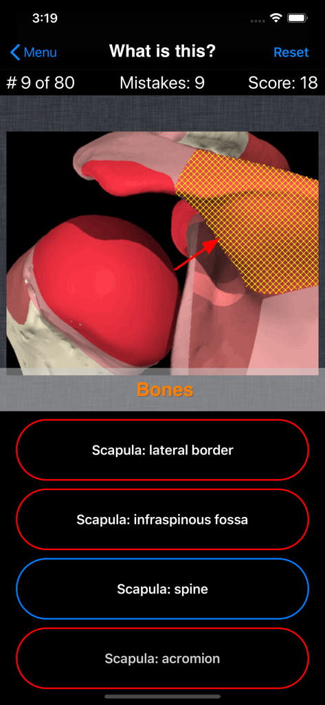 Anatomy Shoulder Quiz - Anatomy Shoulder Quiz app screenshot showing a multiple choice question about scapula bone parts with a 3D medical illustration.