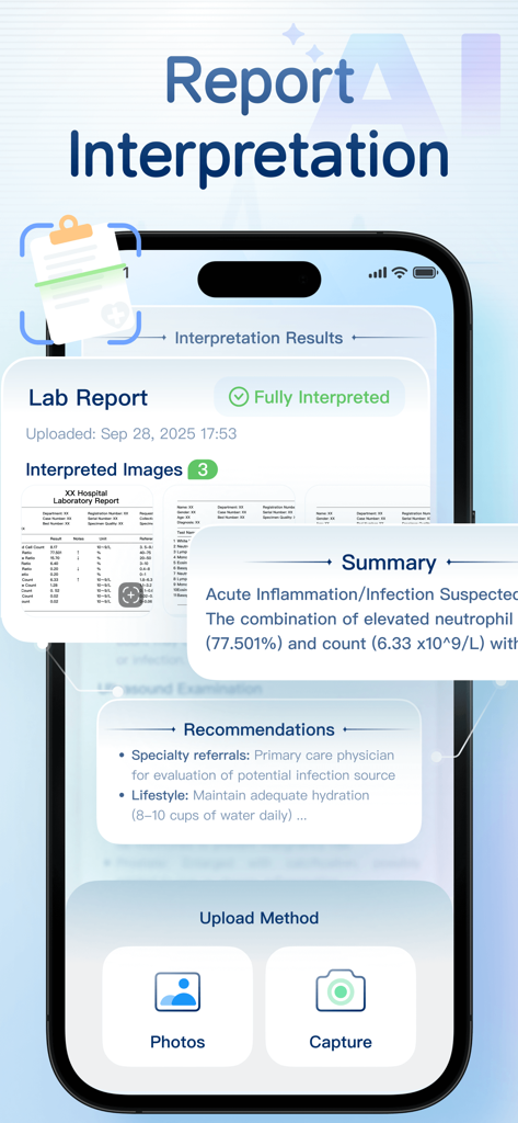 AI Heart Monitor：Heart Rate - AI Heart Monitor app interface showing an automated medical report interpretation with health summary and recommendations.