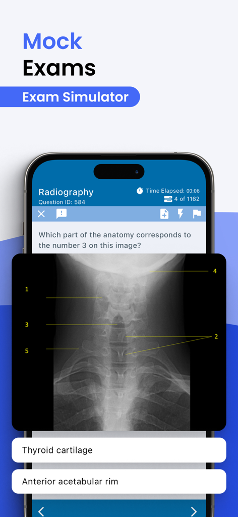 Prepry - Radiography Exam Prep - Radiography mock exam interface with a cervical spine X-ray anatomy question.