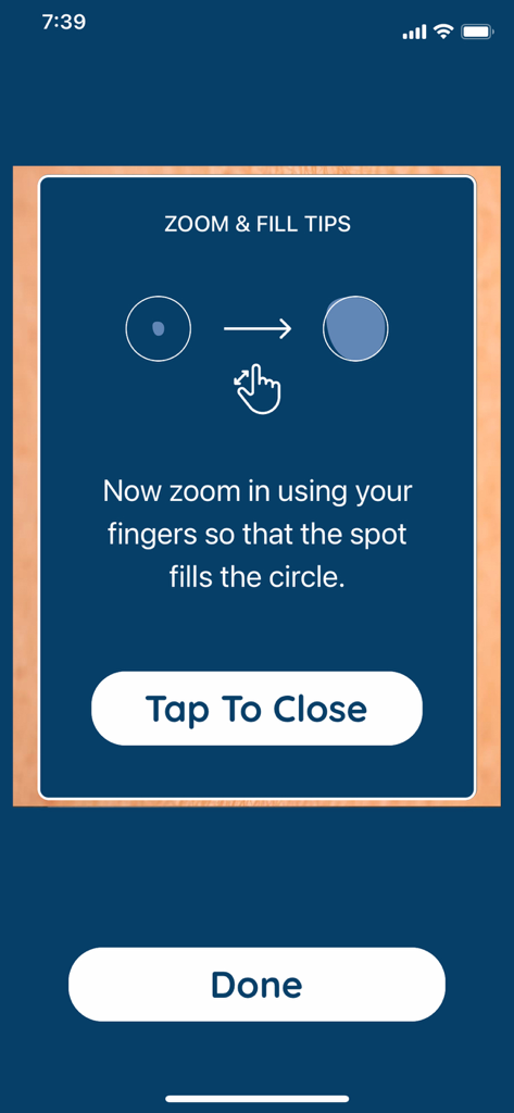 Dermos - Dermos app interface showing instructions for zooming in on a skin spot to fill the guide circle.