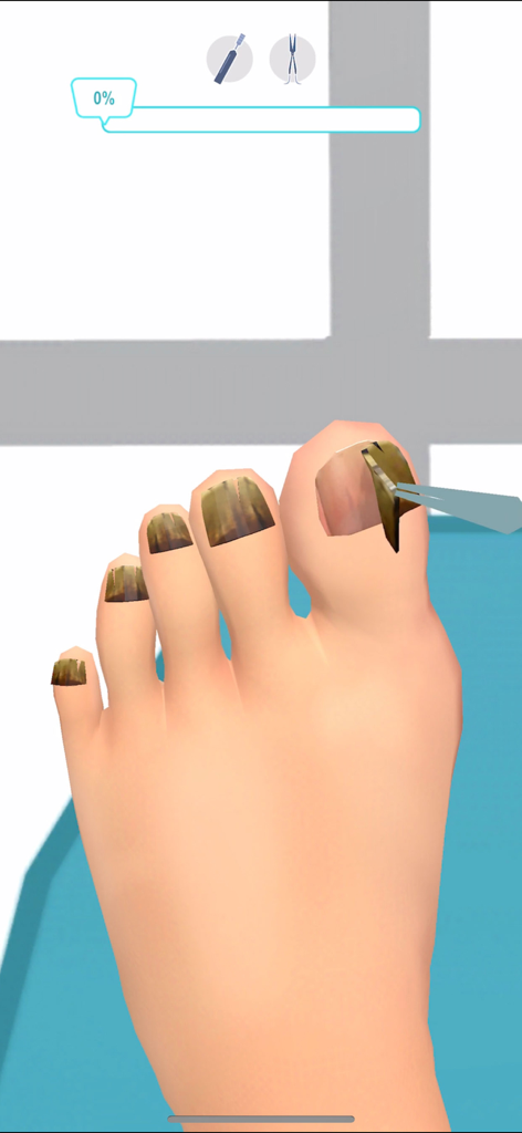 Foot Clinic - ASMR Feet Care - Uma simulação 3D de um procedimento médico descascando uma unha danificada com uma pinça em um ambiente clínico