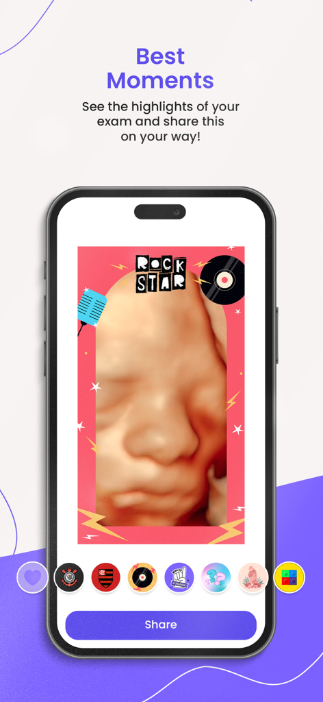 Pantalla de smartphone de la aplicación V-Baby que muestra una ecografía 3D de la cara de un bebé con una pegatina de rock star y un botón para compartir