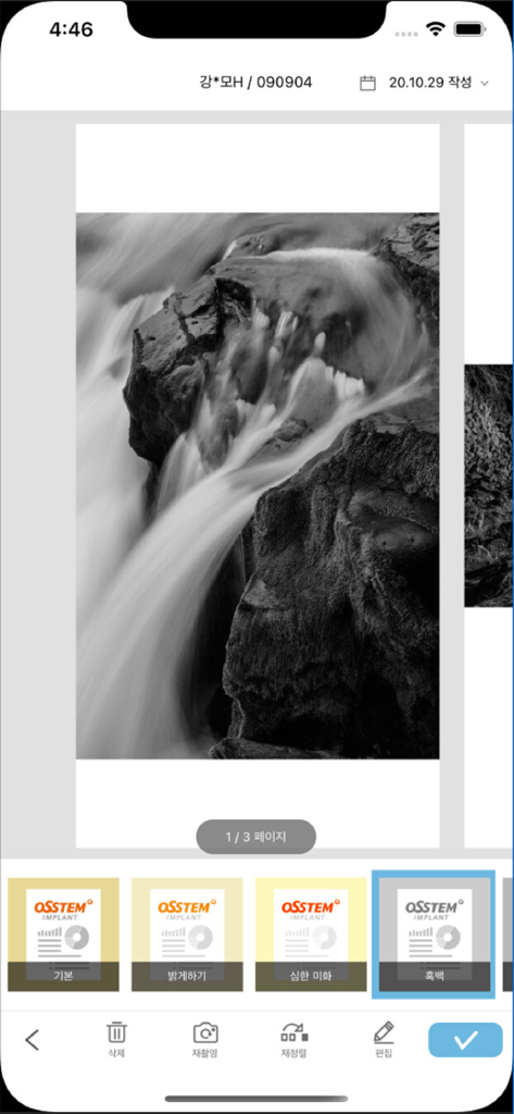 A screenshot of the OSSTEM Chart Scan mobile application showing a scanned image with black and white filter options and editing tools