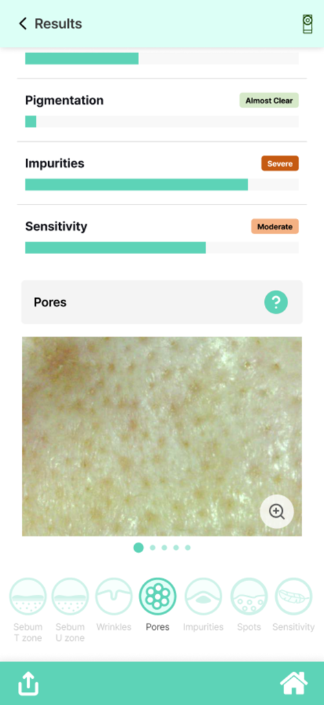 DermoPico Skin - DermoPico Skin analysis results screen showing microscopic pore image and diagnostic scores