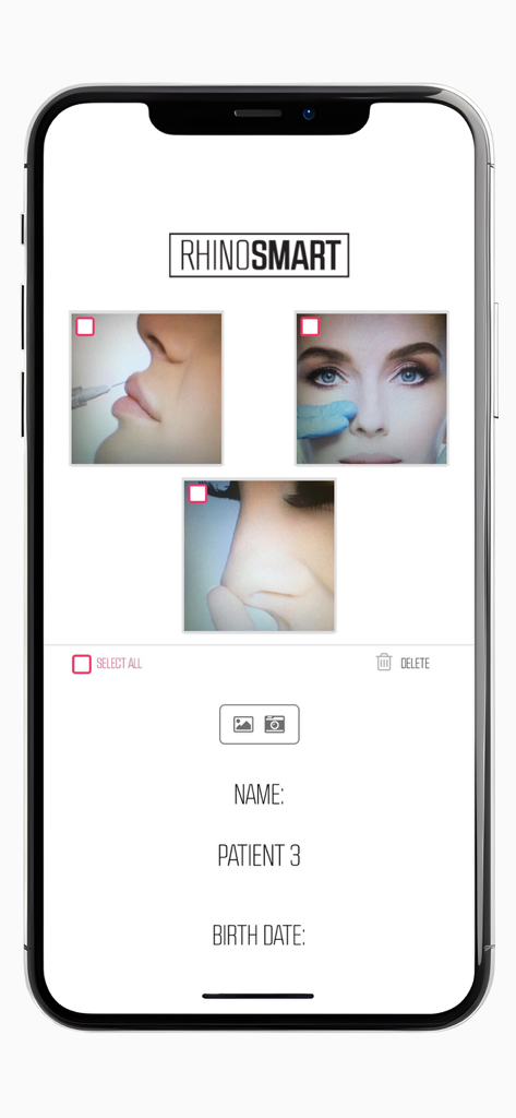 Rhino Smart - Patient profile screen in the Rhino Smart app showing pre and post operative surgery photos