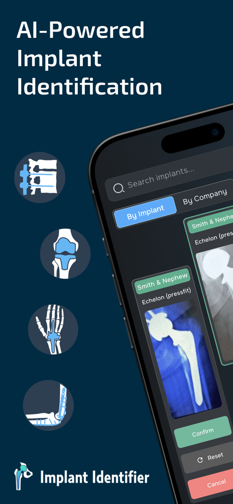 Implant Identifier - Mobile app interface of Implant Identifier showing AI-powered recognition of orthopedic implants from x-rays.